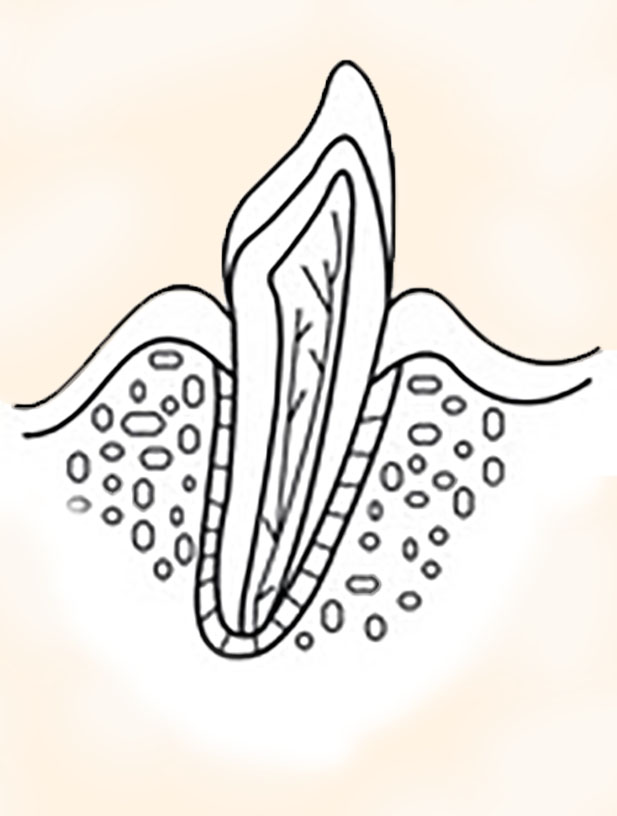 Endodontie Wurzelbehandlung gesunder Zahn