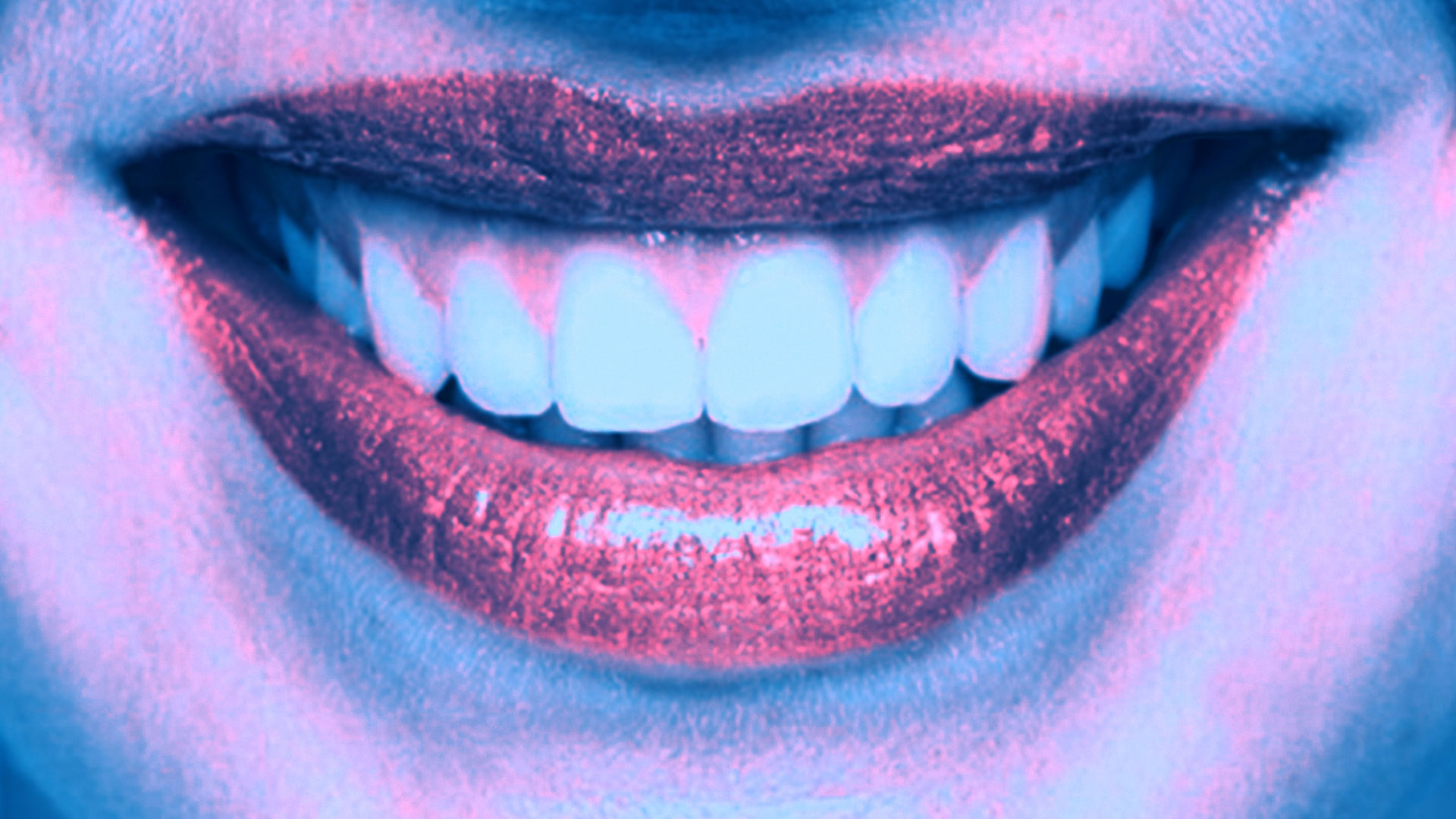 Zahnarzt-Bleaching